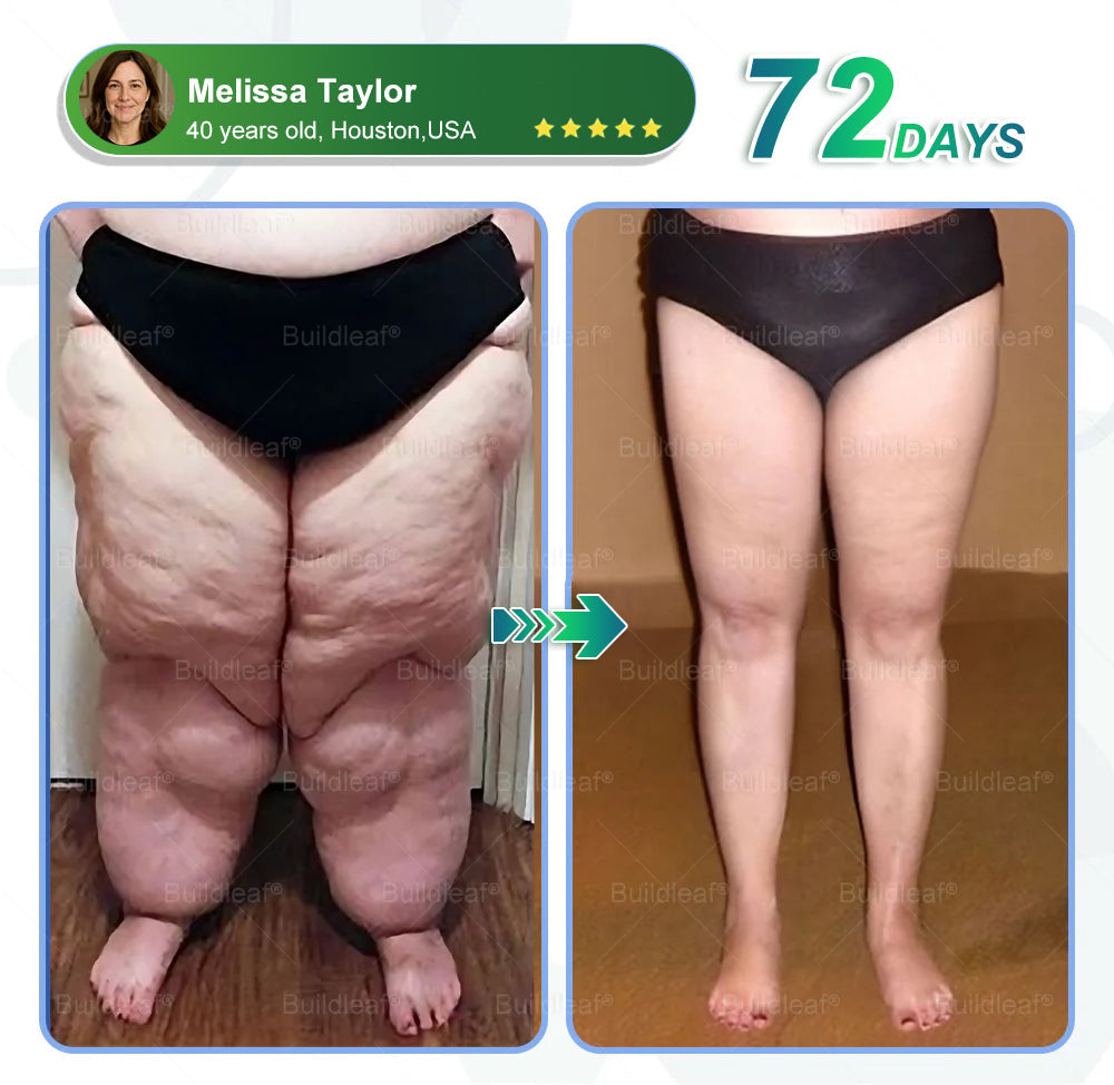 MHRA Official Store | BuildLeaf® SMGT-GLP-1 Nano Microneedle Patch with Collagen & Matrixyl 3000丨Targets Obesity, Loose Skin, High Blood Pressure, Diabetes, Fatty Liver, Joint Pain, Brain Fog, Low Energy, Body Aches, and More