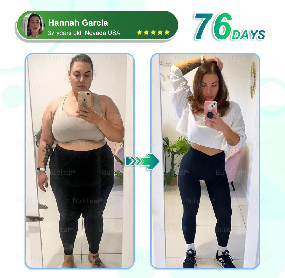 MHRA Official Store | BuildLeaf® SMGT-GLP-1 Nano Microneedle Patch with Collagen & Matrixyl 3000丨Targets Obesity, Loose Skin, High Blood Pressure, Diabetes, Fatty Liver, Joint Pain, Brain Fog, Low Energy, Body Aches, and More