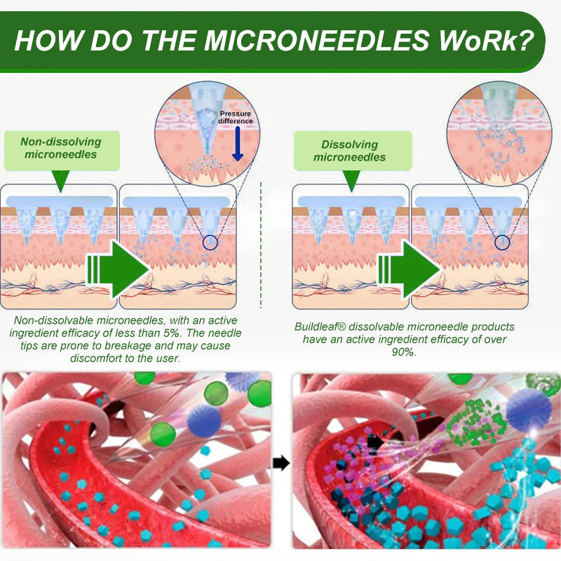 MHRA Official Store | BuildLeaf® SMGT-GLP-1 Nano Microneedle Patch with Collagen & Matrixyl 3000丨Targets Obesity, Loose Skin, High Blood Pressure, Diabetes, Fatty Liver, Joint Pain, Brain Fog, Low Energy, Body Aches, and More